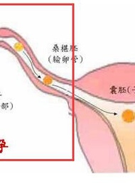 有过宫外孕的经历，该如何备孕呢？