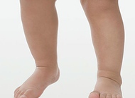 正确看待孩子的神经症、“O”形腿和斜视斜视？