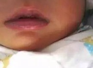 宝宝唇色深是缺氧吗？