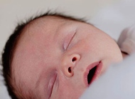 警惕新生儿出血症多发生在生后2～3天