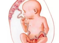 孕期贫血了，对宝宝和妈妈有哪些危害？