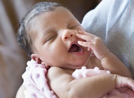 对新生儿乳痂的认识与处理方式