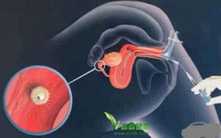 补抵抗力的红薯丸子  