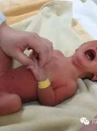 新生宝宝的第一声啼哭与阿氏评分