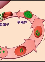 备孕要阻断十大传染病之疟疾