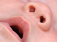 新生儿鼻塞，一定就是感冒了吗？