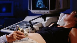 补抵抗力的红薯丸子  