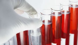 补抵抗力的红薯丸子  