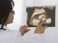 如何检查出胎儿是否脐带绕颈