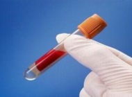 血HCG检查的新作用