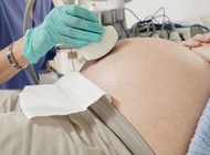 孕晚期产检