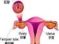 性别鉴定竟致腹中胎儿畸形？