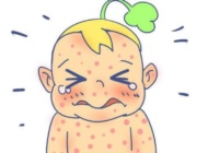 宝宝常见过敏症状